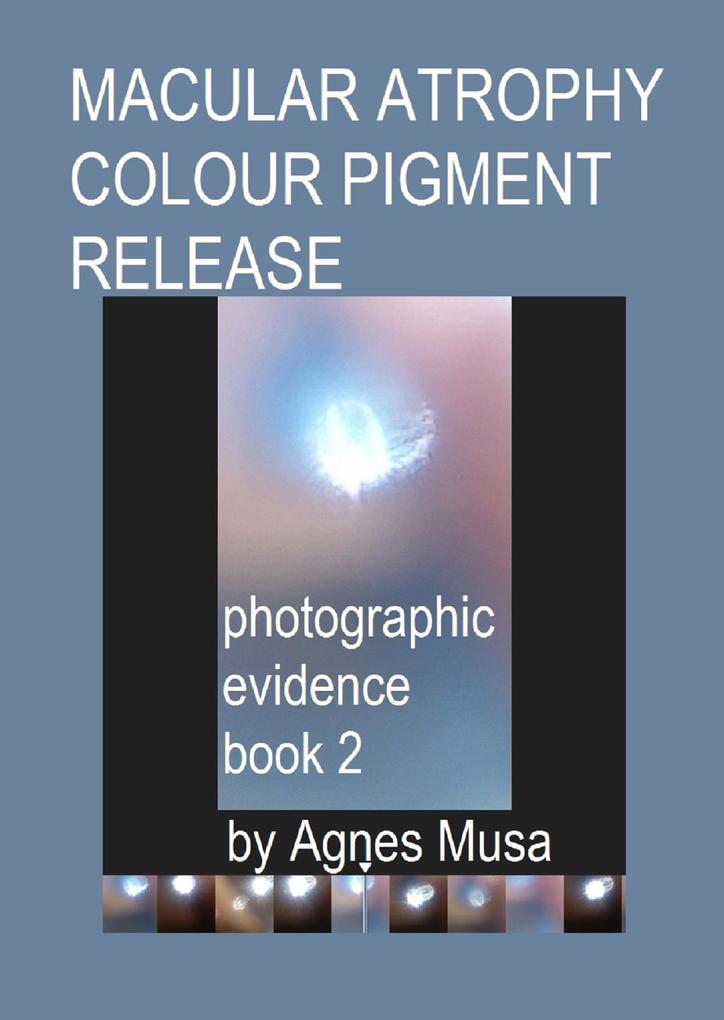 Macular Atrophy Colour Pigment Release Photographic Evidence Book 2 (Macular Degeneration Atrophy Photographic Evidence Series of Books #13)