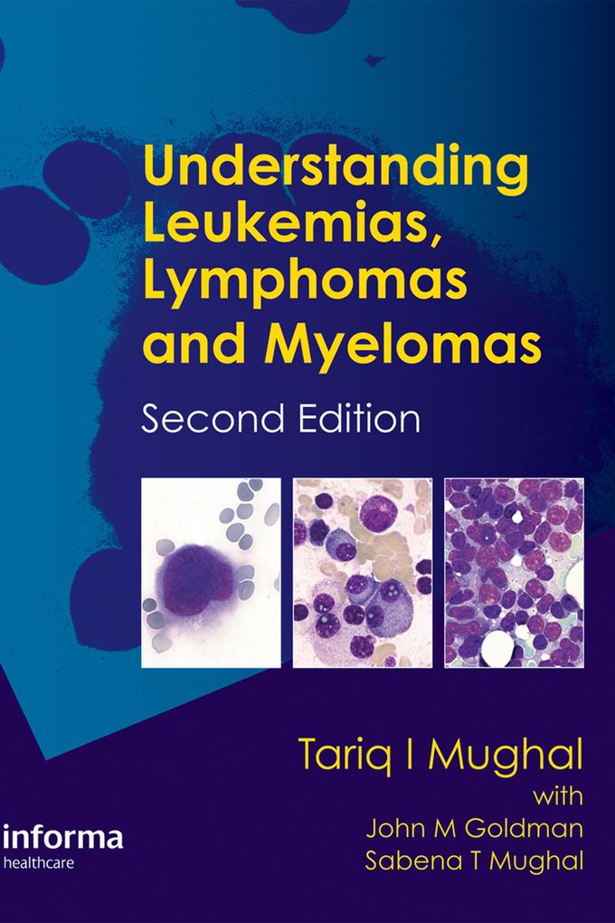Understanding Leukemias Lymphomas and Myelomas