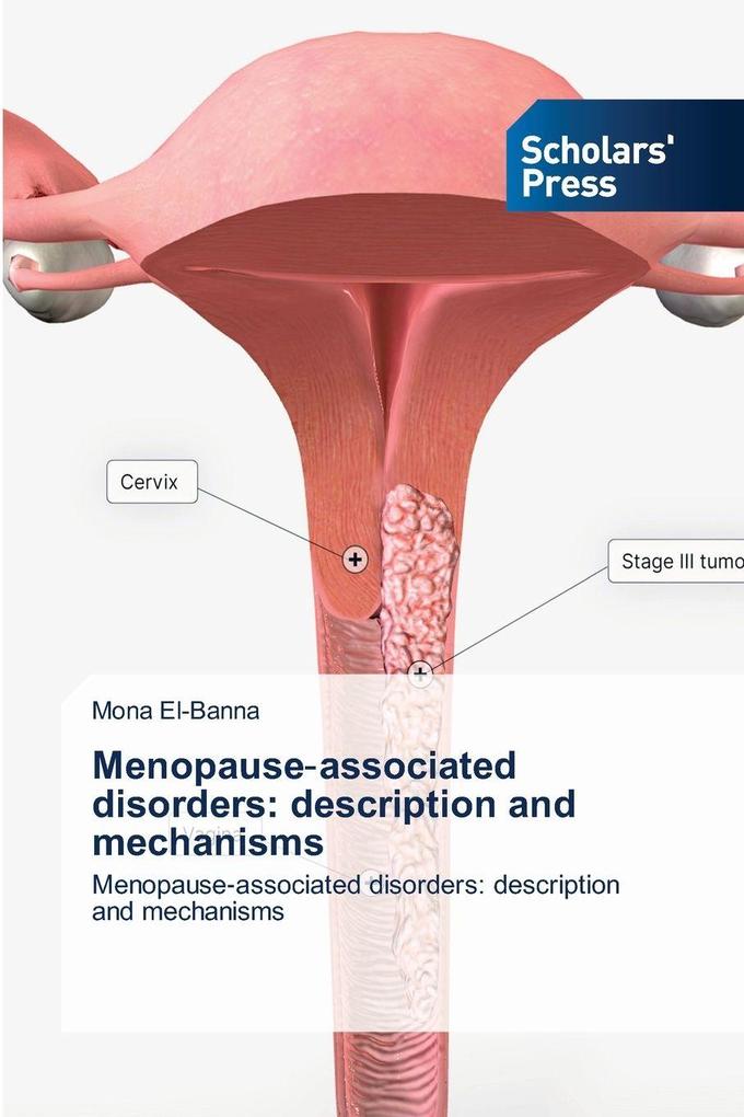 Menopauseassociated disorders: description and mechanisms
