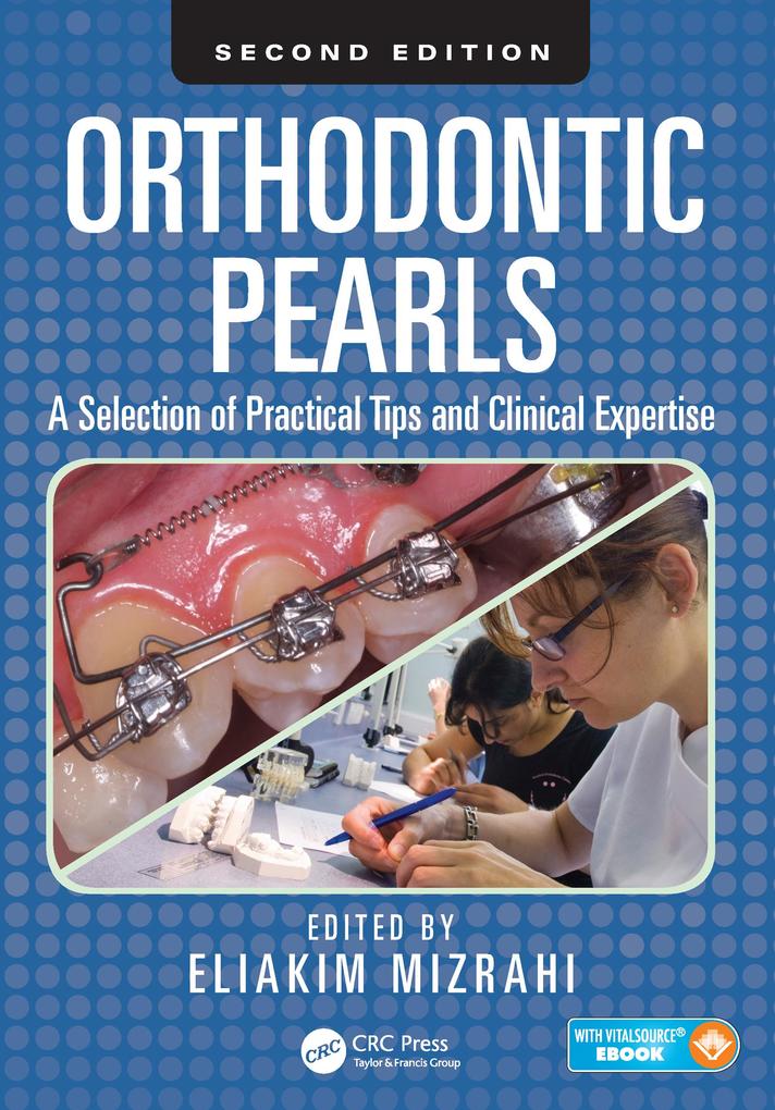 Orthodontic Pearls