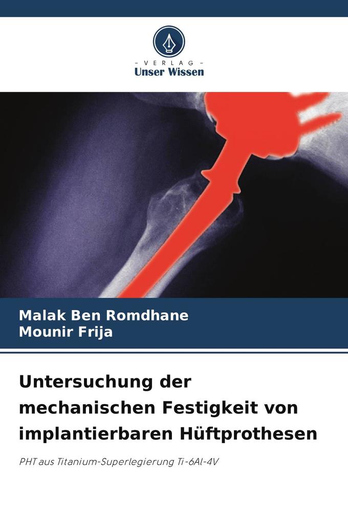 Untersuchung der mechanischen Festigkeit von implantierbaren Hüftprothesen