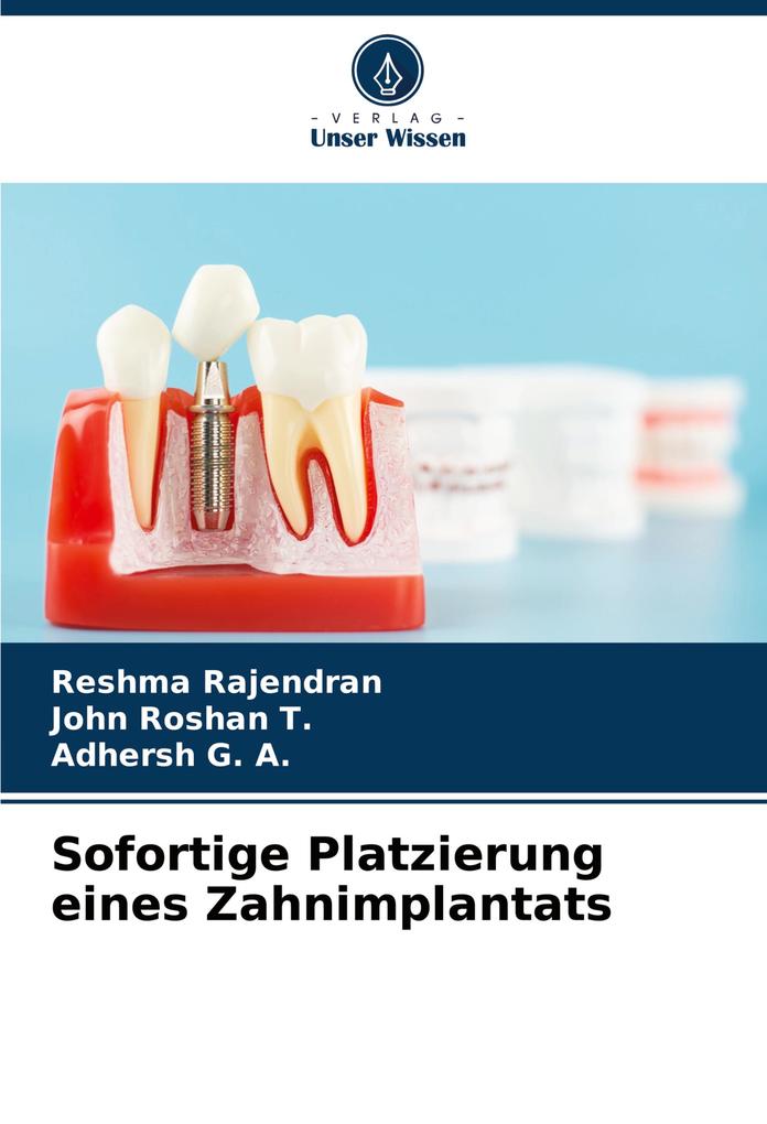 Sofortige Platzierung eines Zahnimplantats
