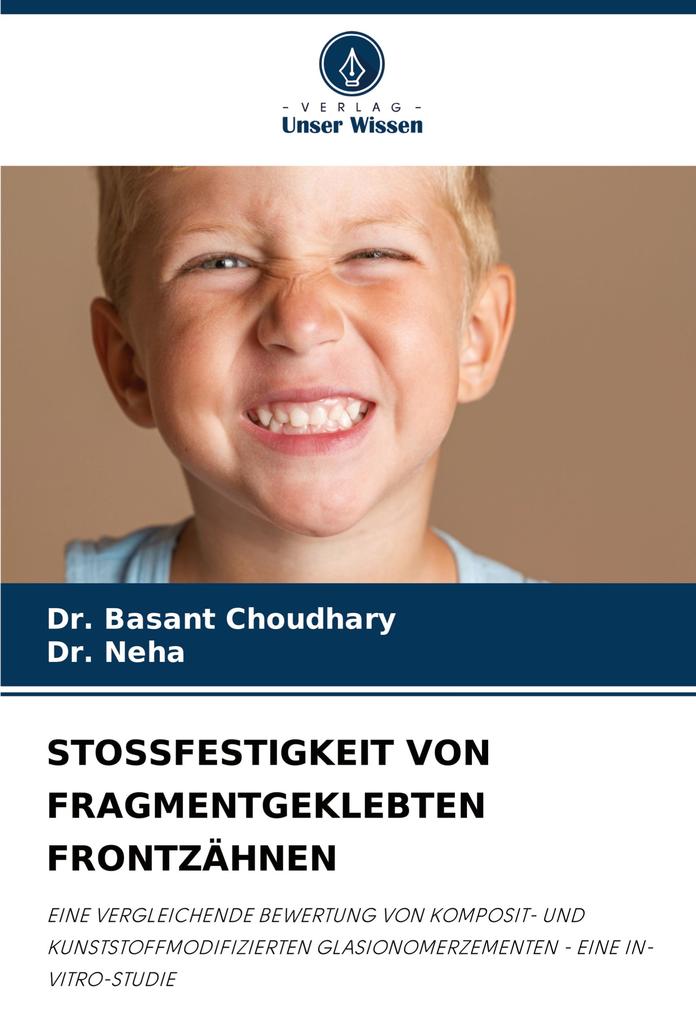 STOSSFESTIGKEIT VON FRAGMENTGEKLEBTEN FRONTZÄHNEN