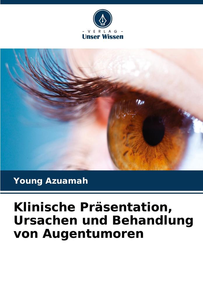 Klinische Präsentation Ursachen und Behandlung von Augentumoren