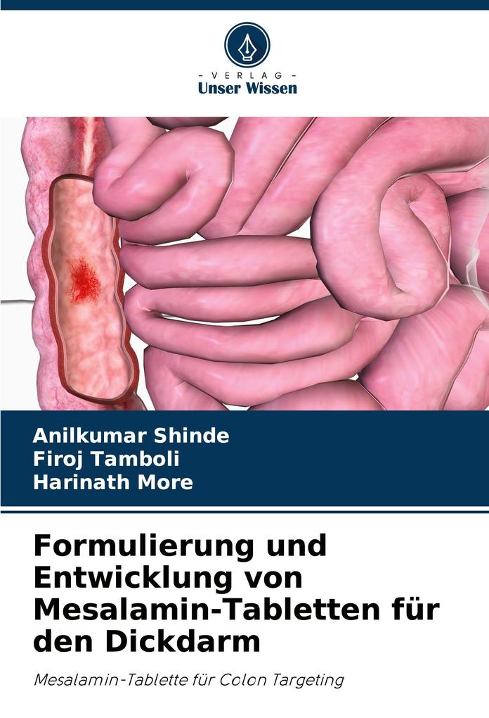Formulierung und Entwicklung von Mesalamin-Tabletten für den Dickdarm