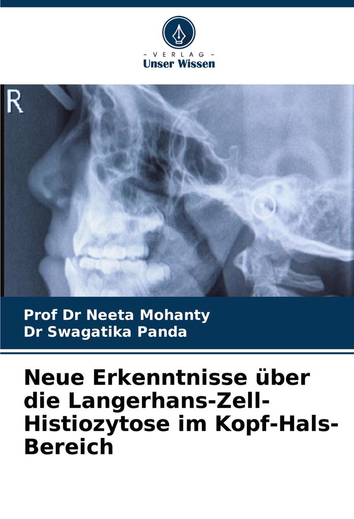 Neue Erkenntnisse über die Langerhans-Zell-Histiozytose im Kopf-Hals-Bereich