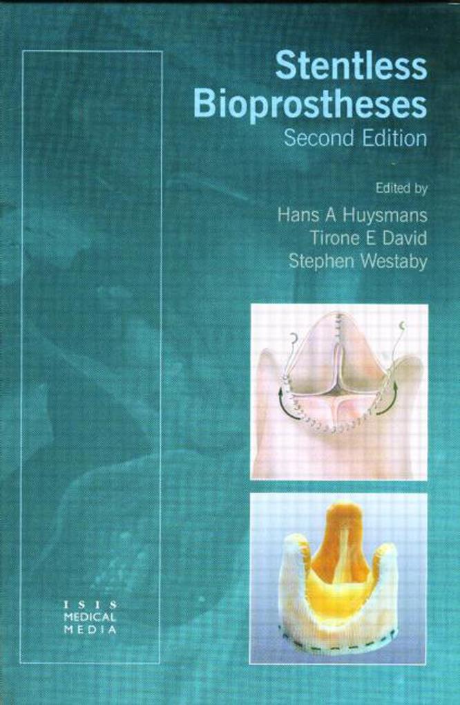 Stentless Bioprostheses