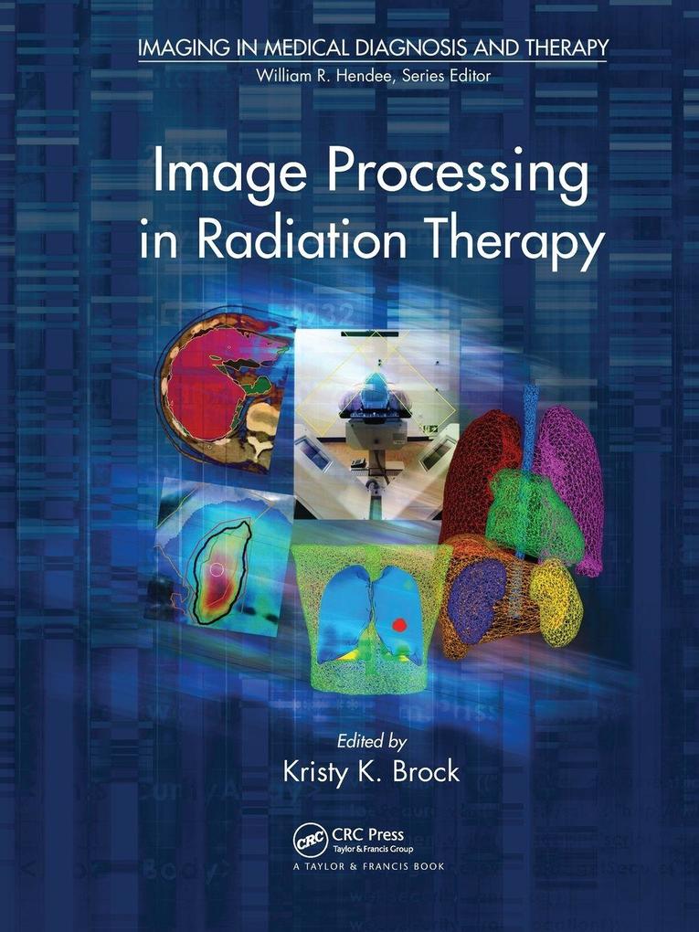 Image Processing in Radiation Therapy