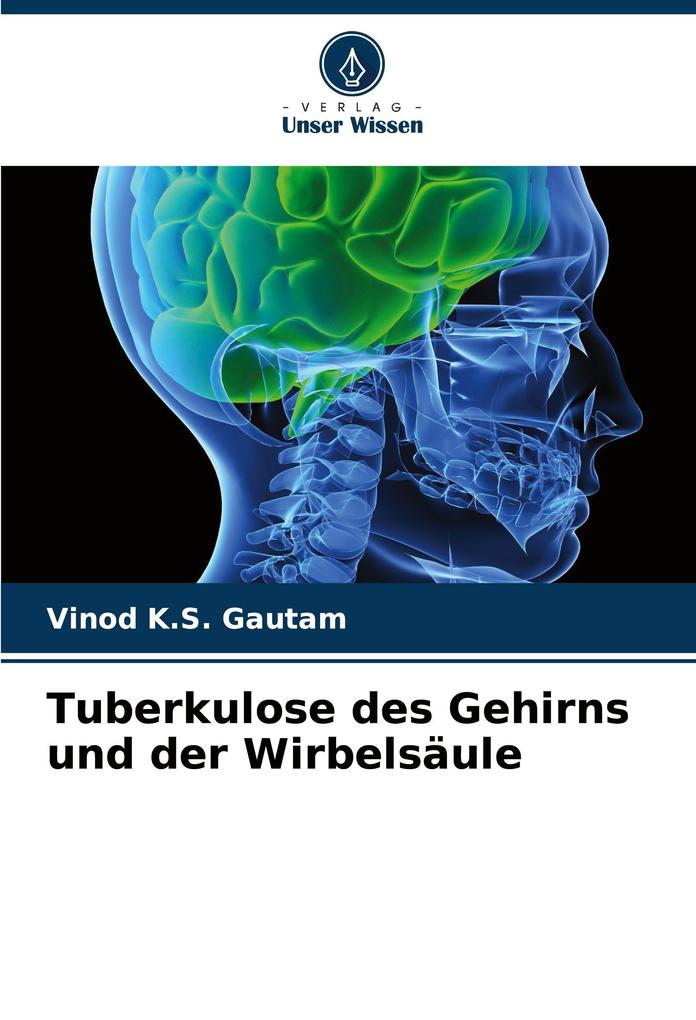 Tuberkulose des Gehirns und der Wirbelsäule