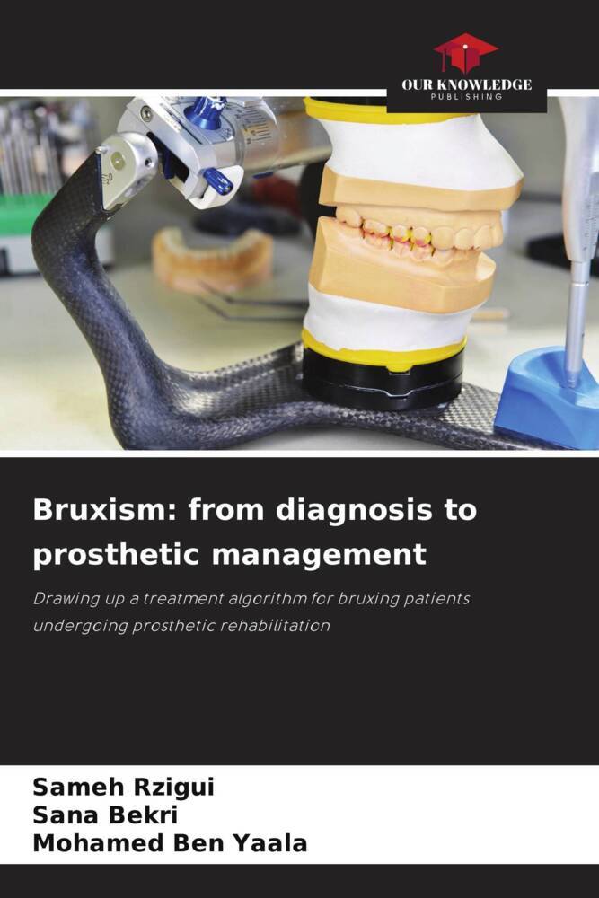 Bruxism: from diagnosis to prosthetic management
