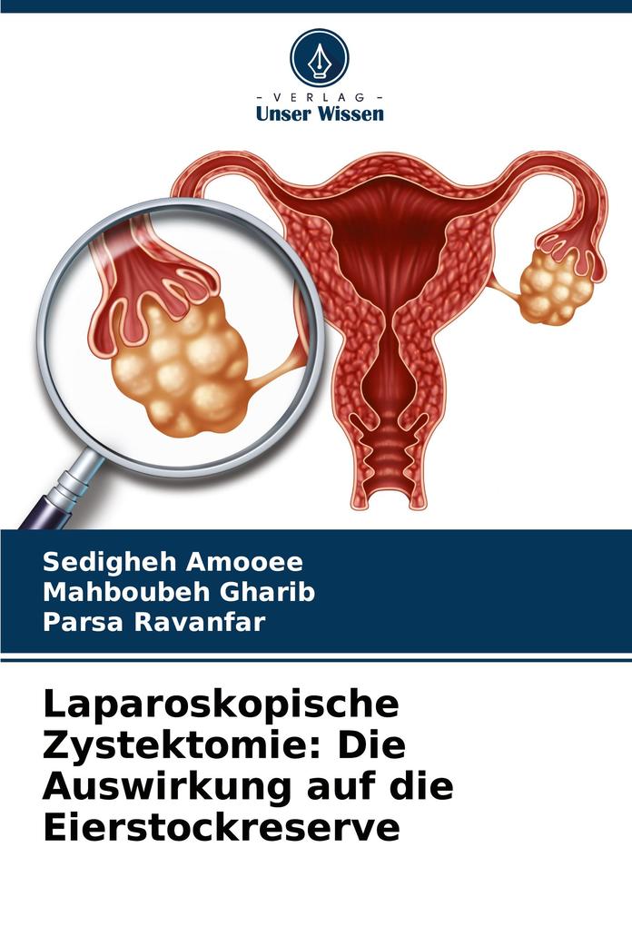 Laparoskopische Zystektomie: Die Auswirkung auf die Eierstockreserve