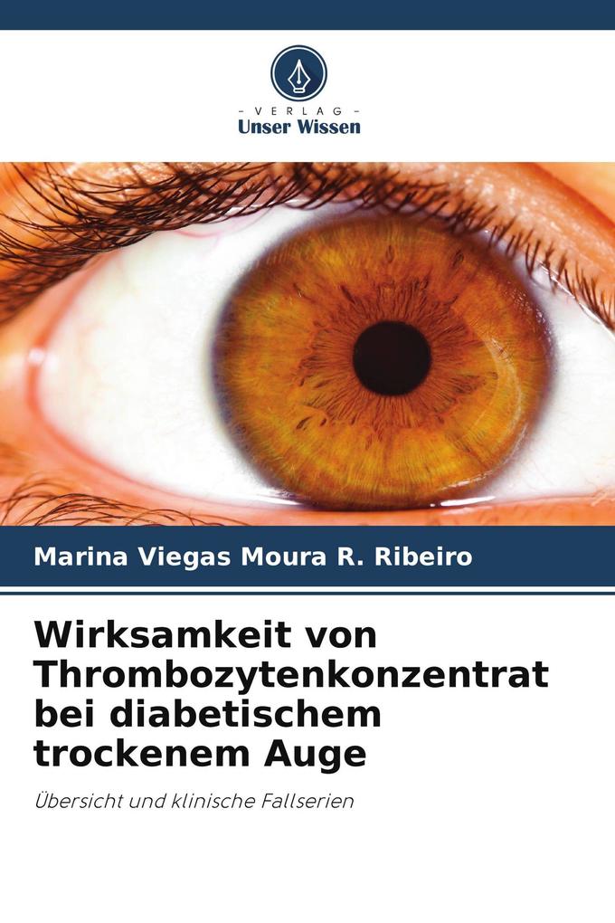 Wirksamkeit von Thrombozytenkonzentrat bei diabetischem trockenem Auge
