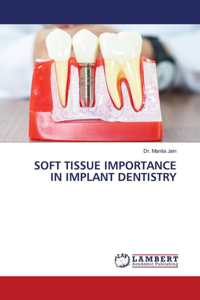 SOFT TISSUE IMPORTANCE IN IMPLANT DENTISTRY