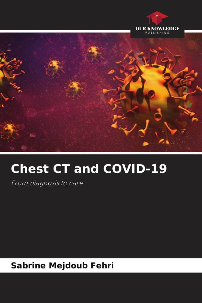 Chest CT and COVID-19