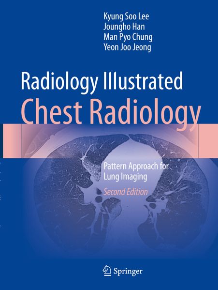 Radiology Illustrated: Chest Radiology