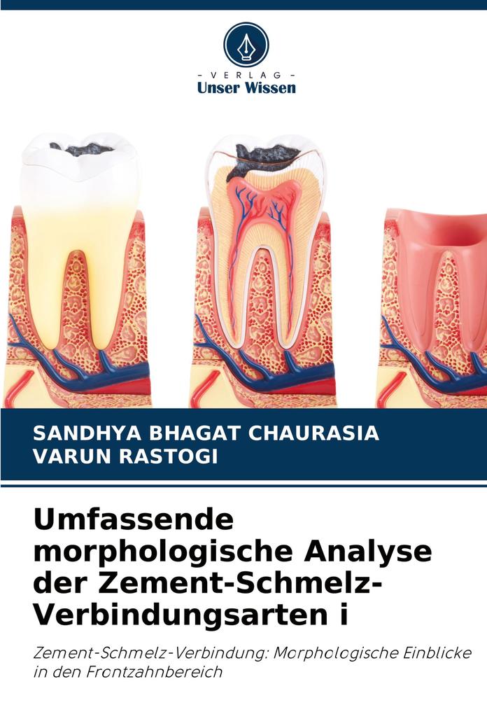 Umfassende morphologische Analyse der Zement-Schmelz-Verbindungsarten i