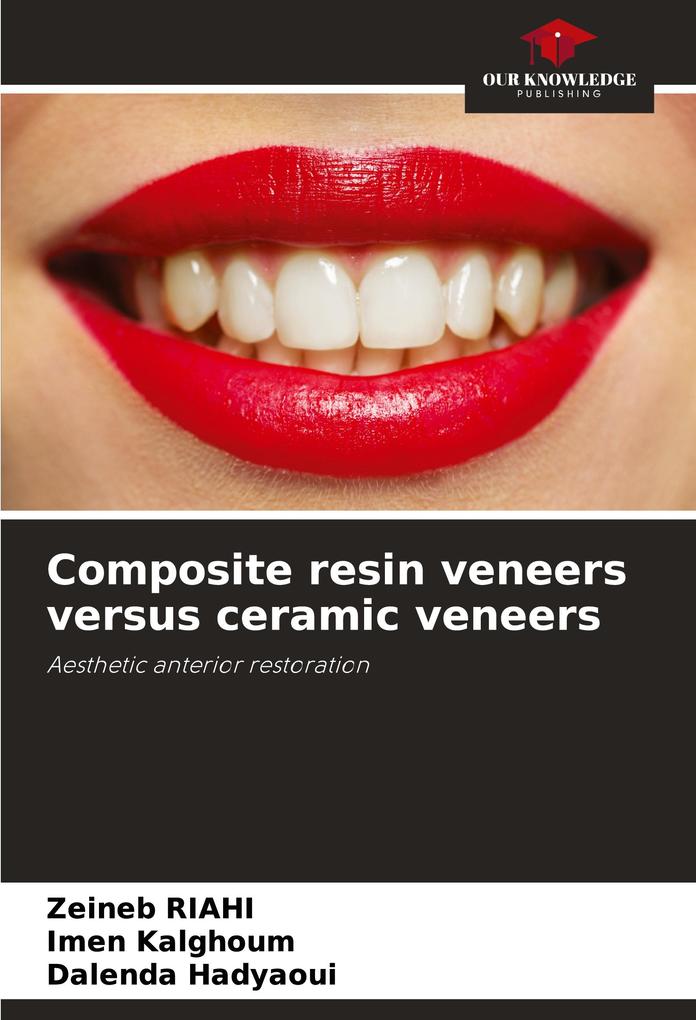 Composite resin veneers versus ceramic veneers