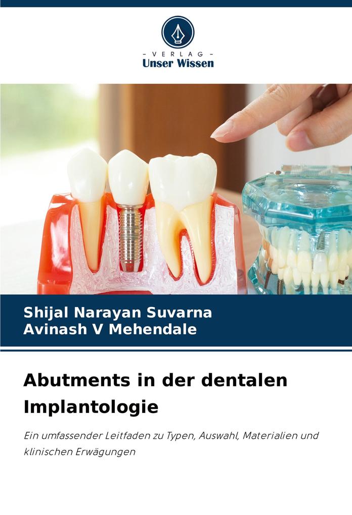 Abutments in der dentalen Implantologie