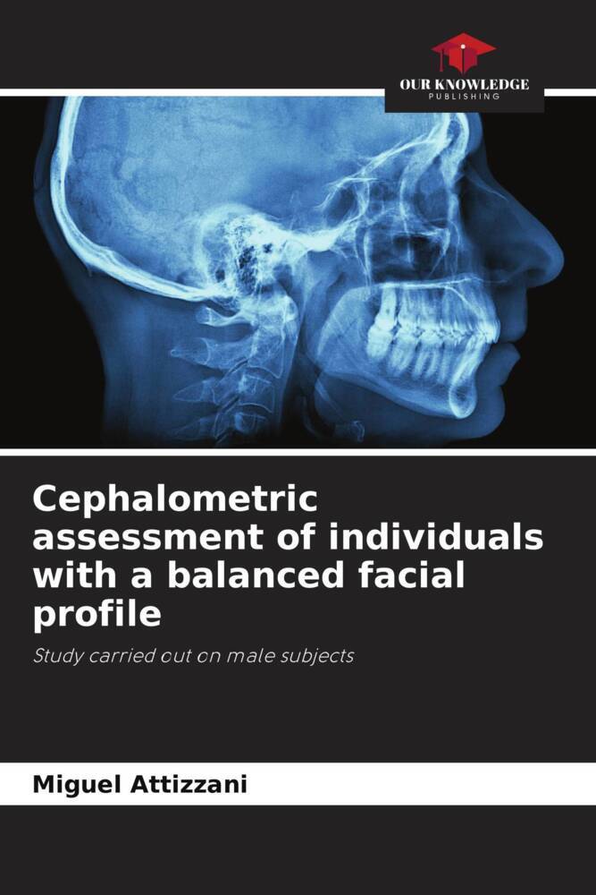 Cephalometric assessment of individuals with a balanced facial profile