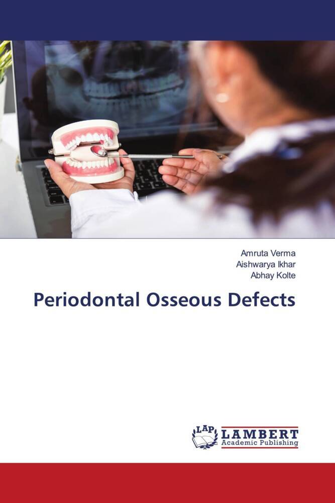 Periodontal Osseous Defects