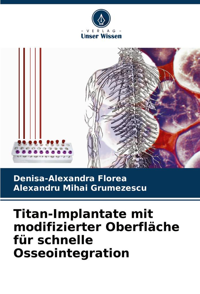 Titan-Implantate mit modifizierter Oberfläche für schnelle Osseointegration