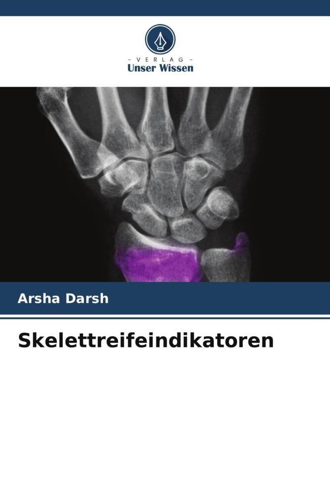 Skelettreifeindikatoren