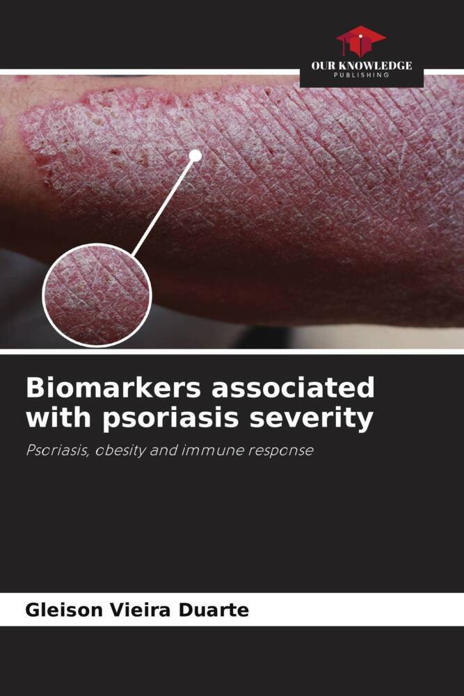 Biomarkers associated with psoriasis severity