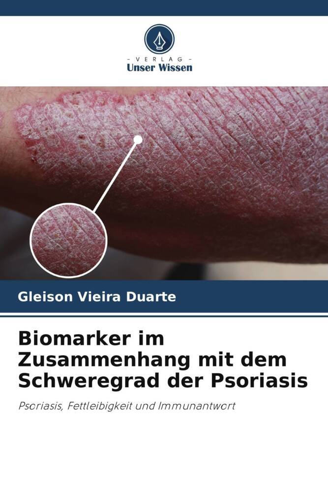 Biomarker im Zusammenhang mit dem Schweregrad der Psoriasis