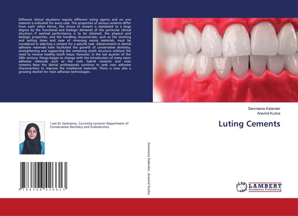 Luting Cements