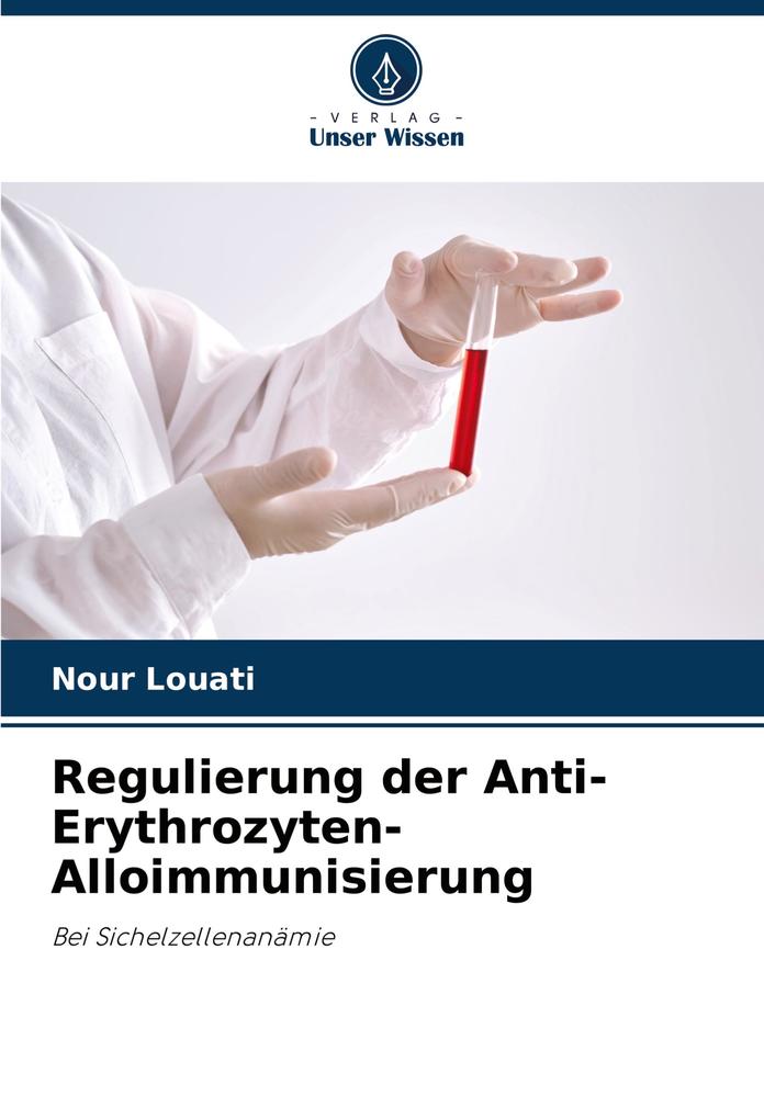 Regulierung der Anti-Erythrozyten-Alloimmunisierung