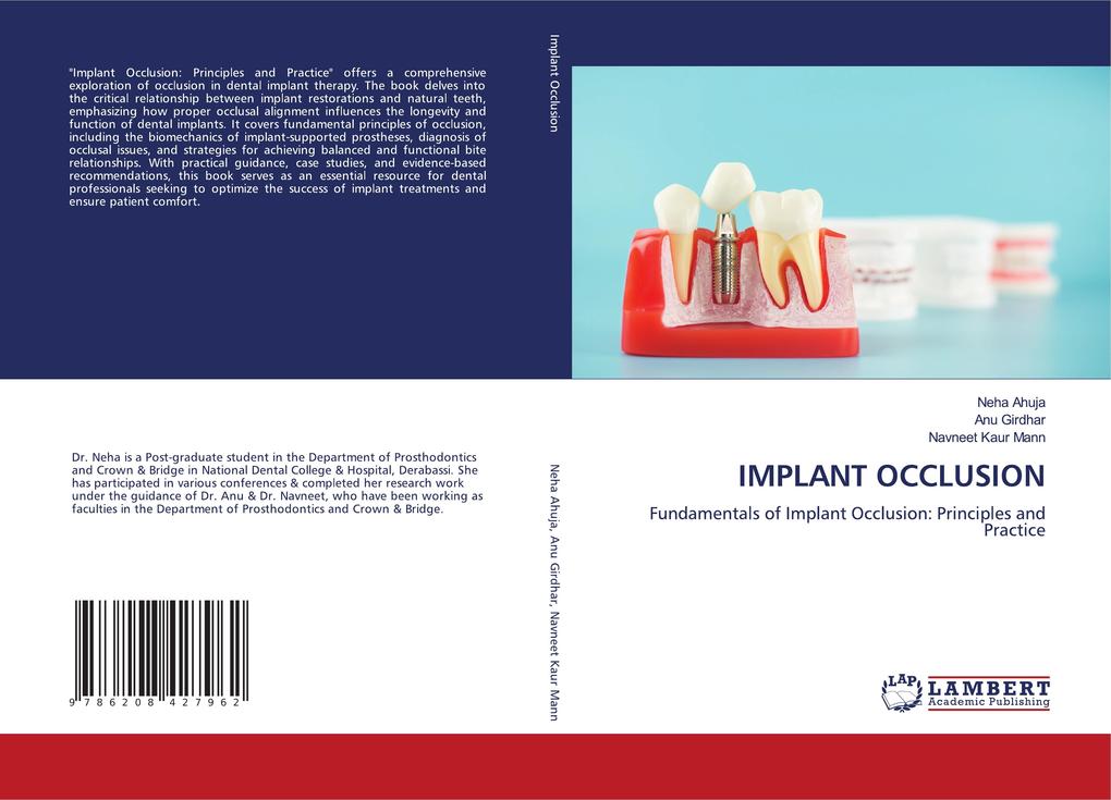 IMPLANT OCCLUSION