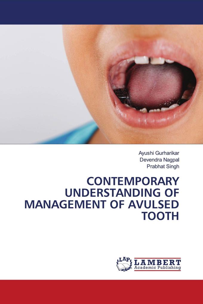 CONTEMPORARY UNDERSTANDING OF MANAGEMENT OF AVULSED TOOTH
