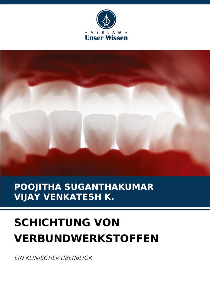 SCHICHTUNG VON VERBUNDWERKSTOFFEN
