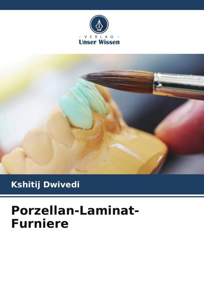 Porzellan-Laminat-Furniere
