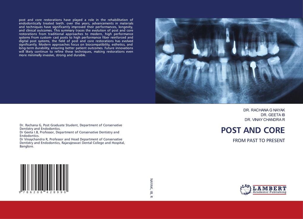 POST AND CORE