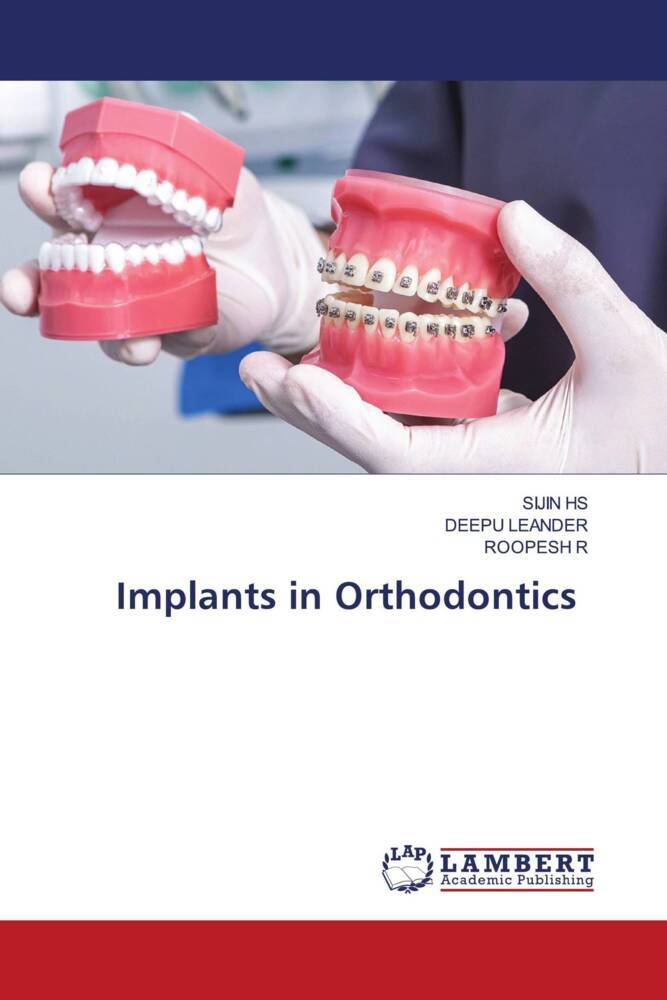 Implants in Orthodontics
