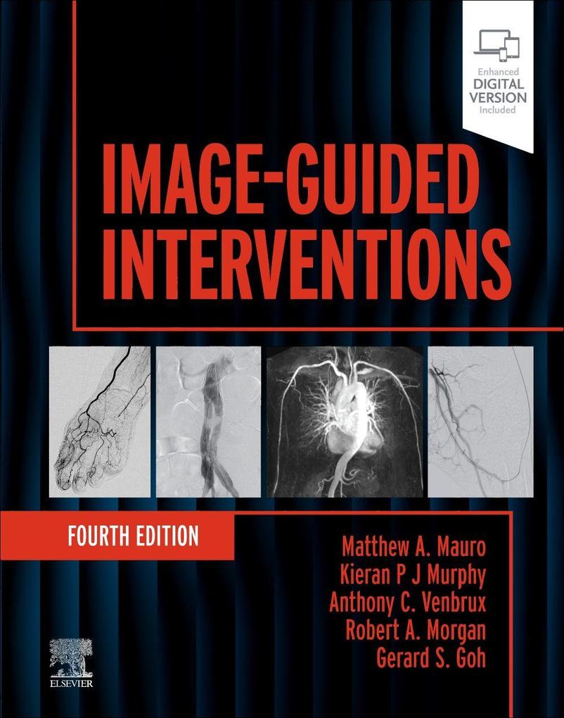 Image-Guided Interventions