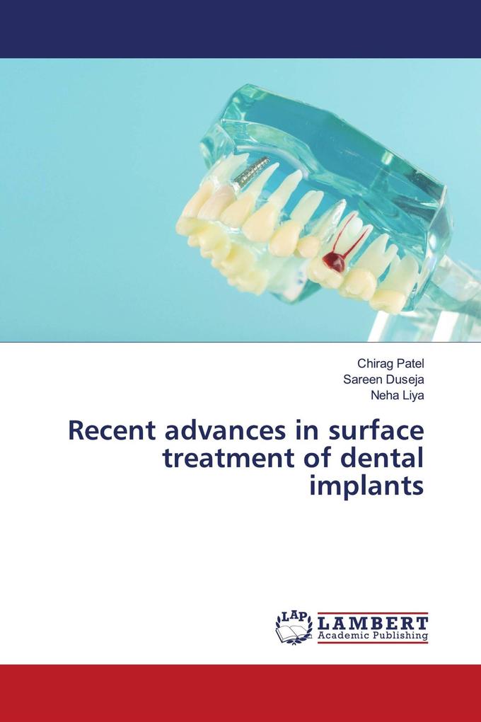 Recent advances in surface treatment of dental implants