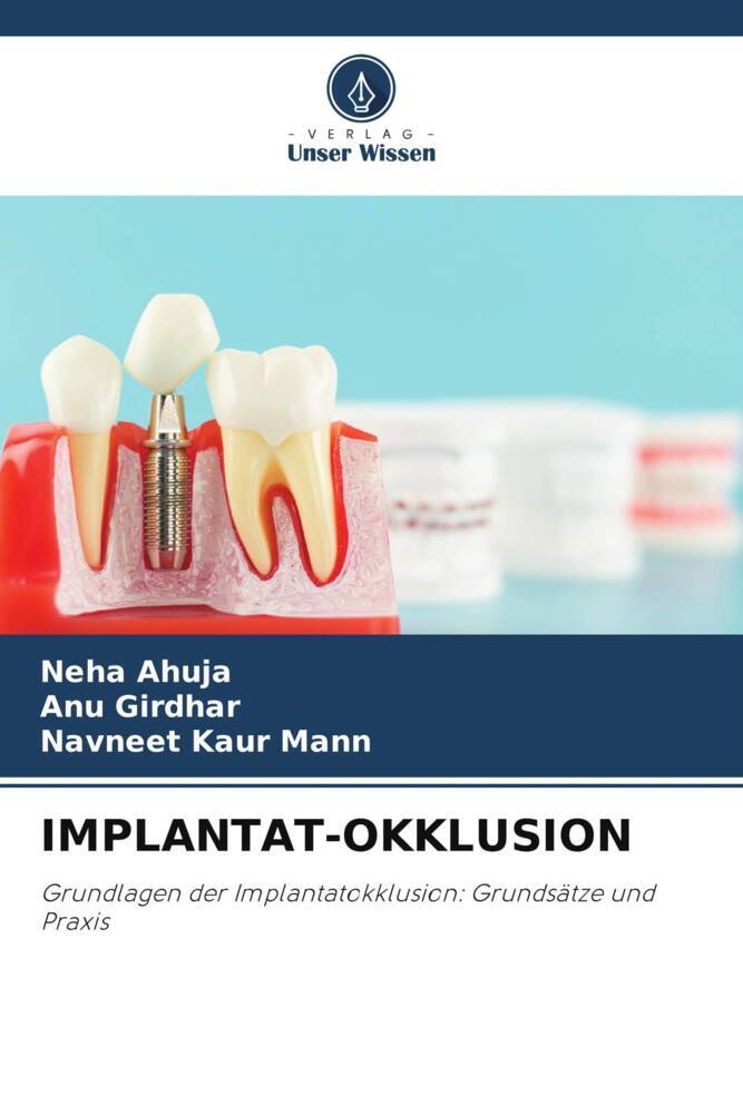 IMPLANTAT-OKKLUSION