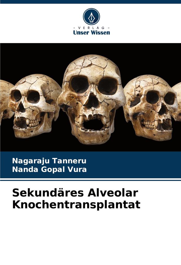 Sekundäres Alveolar Knochentransplantat