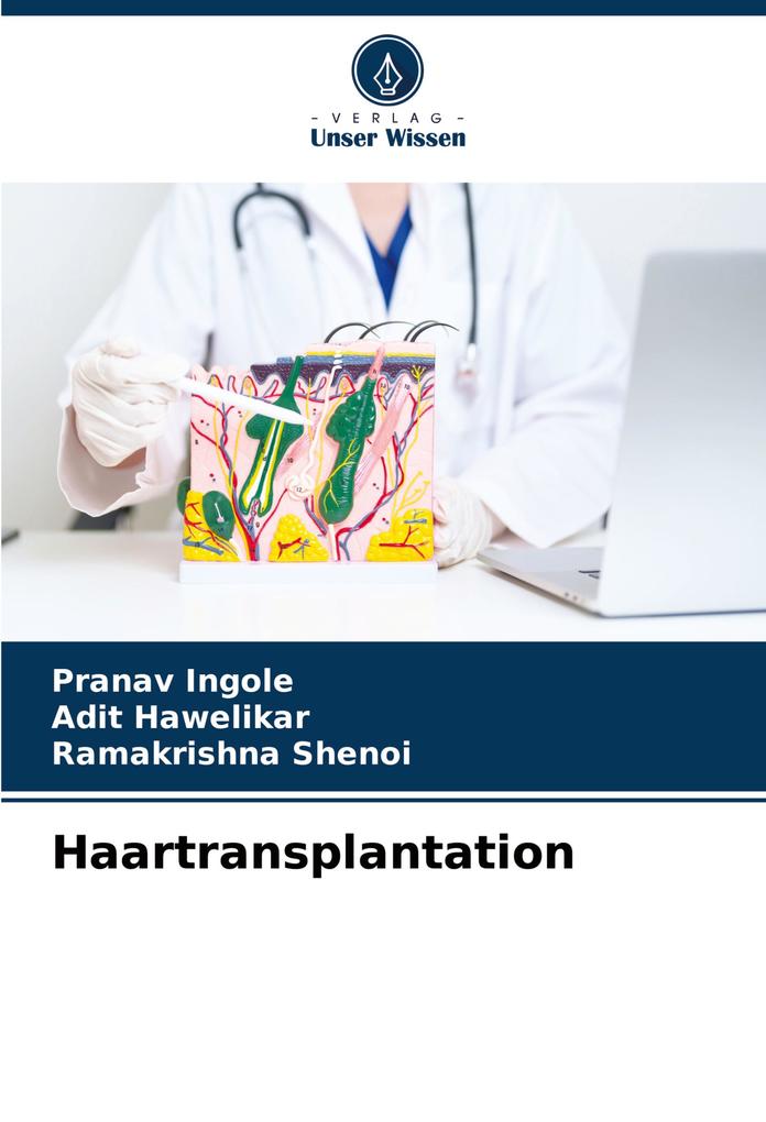 Haartransplantation