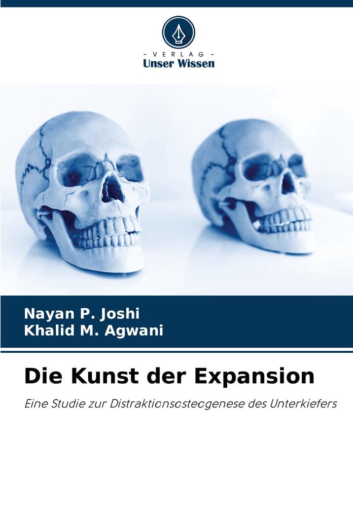 Die Kunst der Expansion