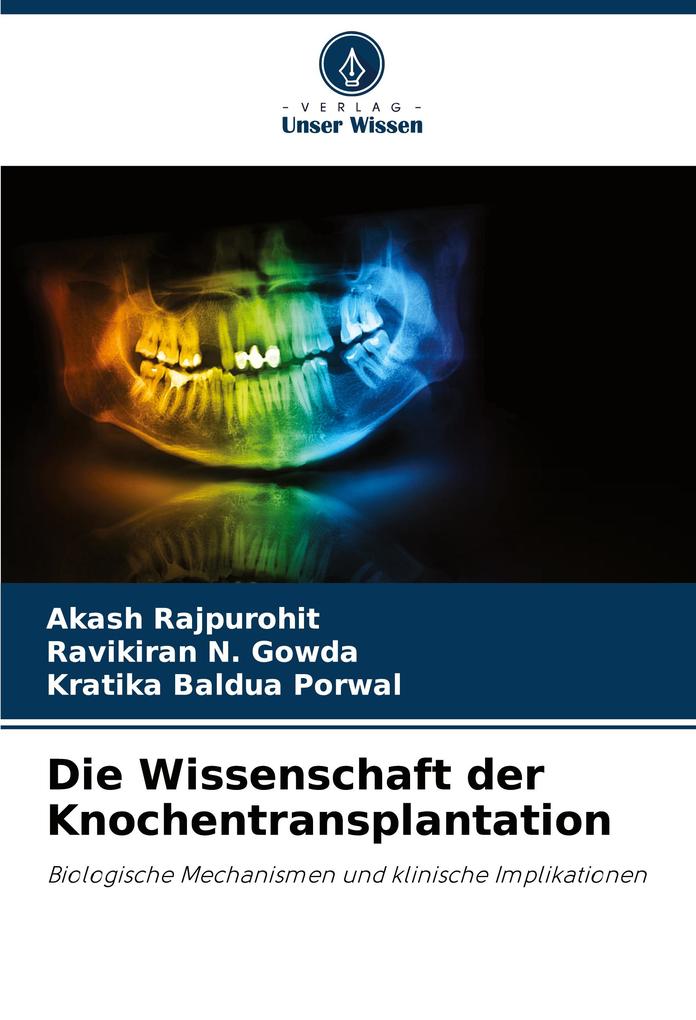 Die Wissenschaft der Knochentransplantation
