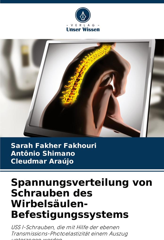 Spannungsverteilung von Schrauben des Wirbelsäulen-Befestigungssystems