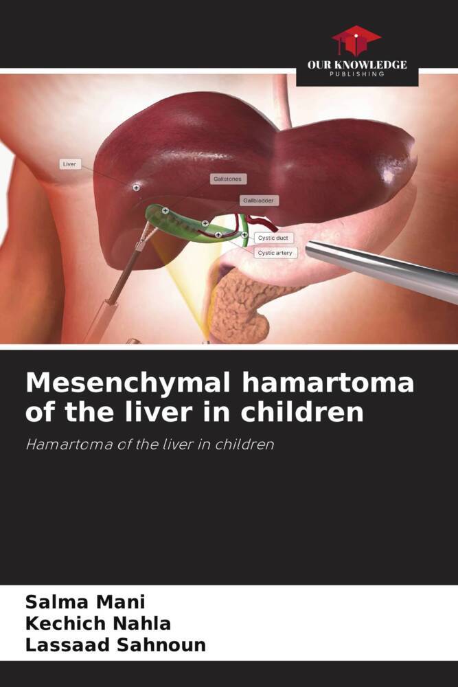 Mesenchymal hamartoma of the liver in children