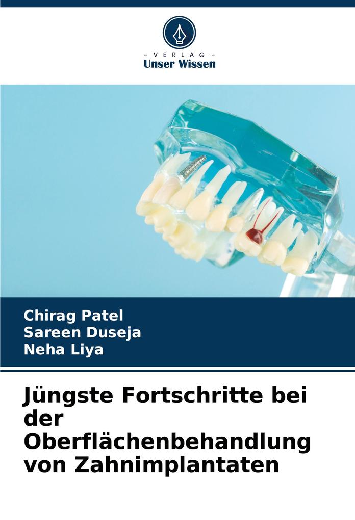 Jüngste Fortschritte bei der Oberflächenbehandlung von Zahnimplantaten