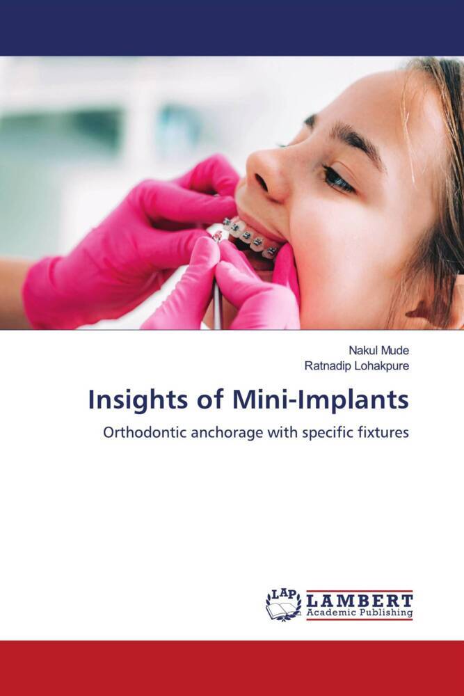 Insights of Mini-Implants