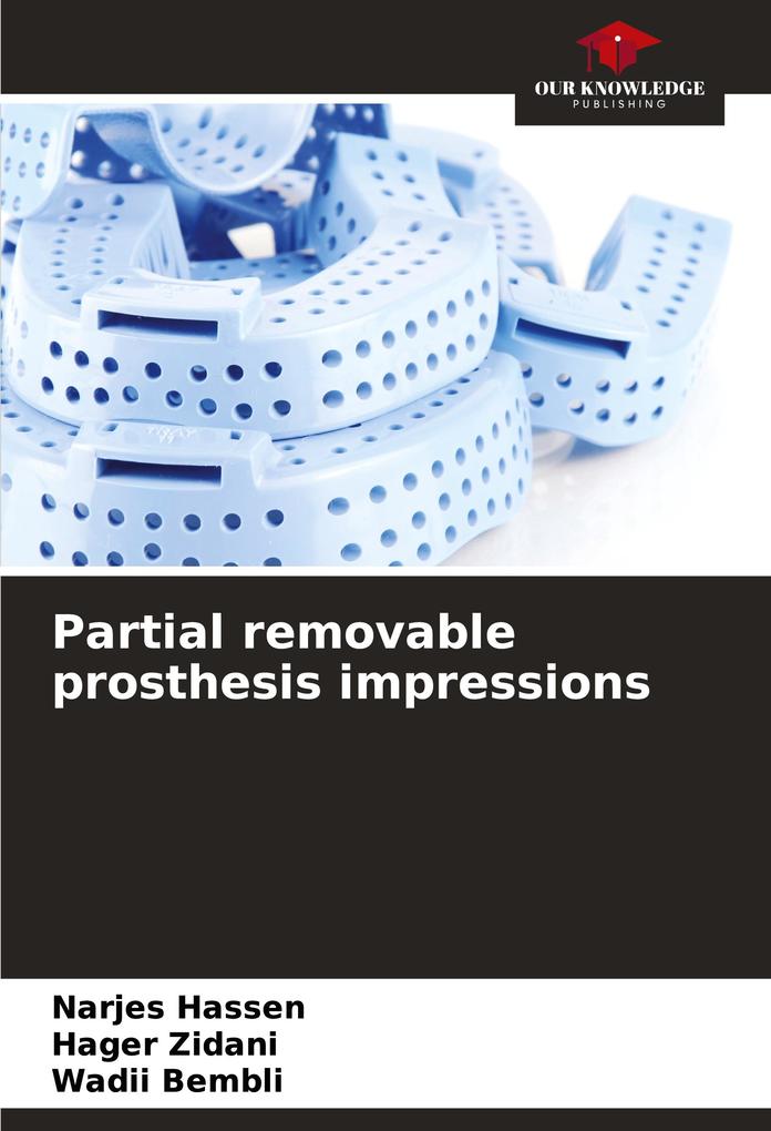 Partial removable prosthesis impressions