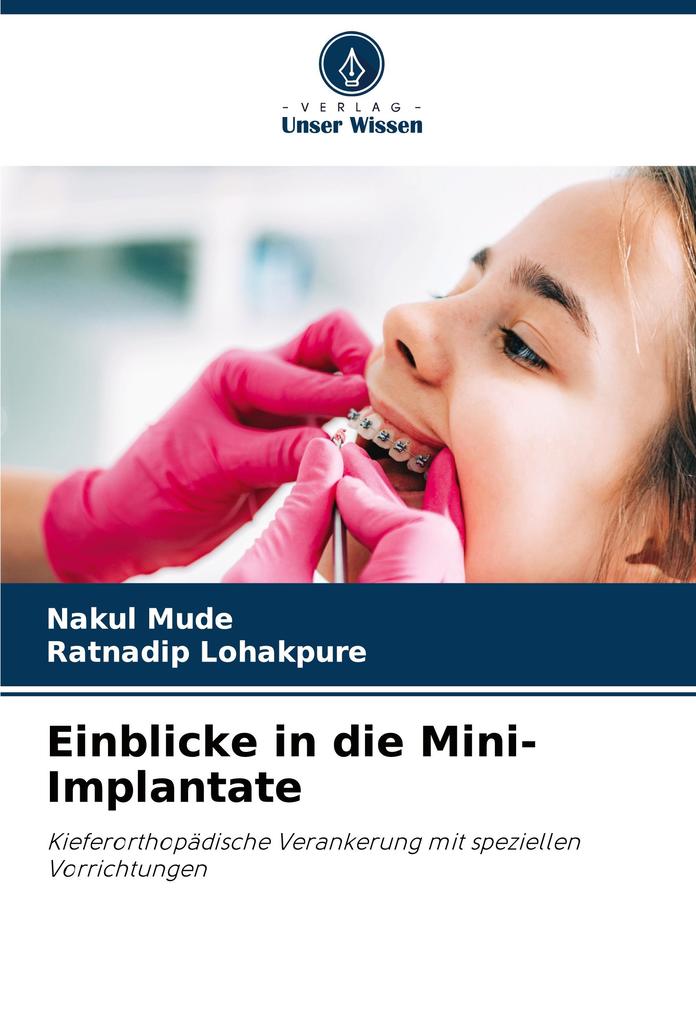 Einblicke in die Mini-Implantate