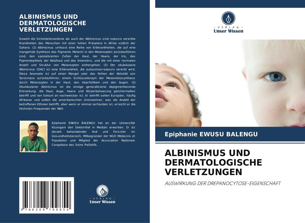 ALBINISMUS UND DERMATOLOGISCHE VERLETZUNGEN